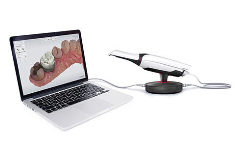 口腔内スキャナー